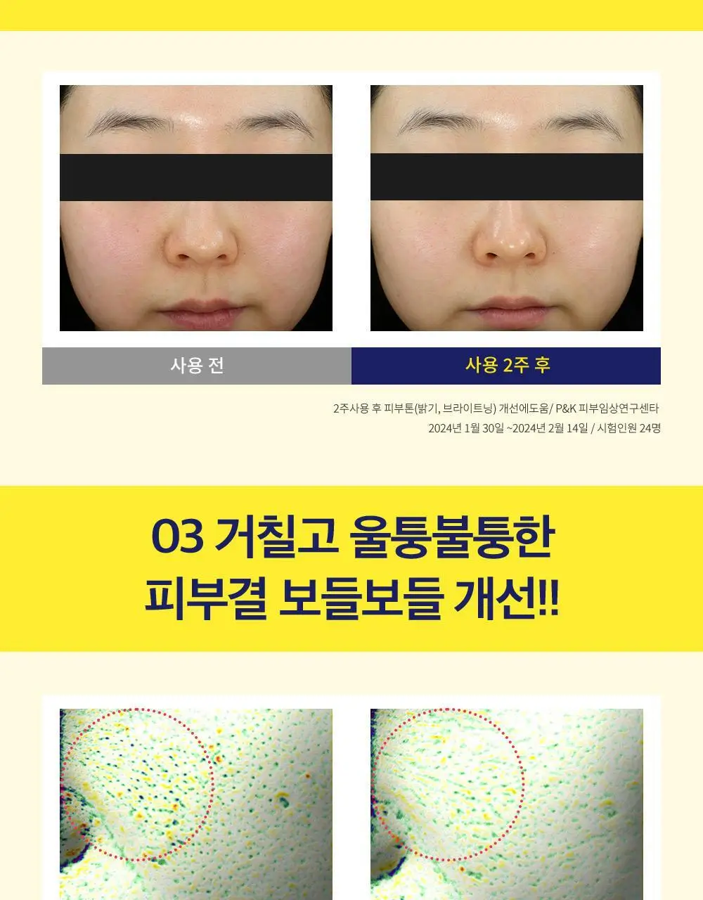 [기미잡티/비타민팩] CKD 비타씨테카 기미잡티샷 마스크 4매 기획 (+1매) 상세페이지 10